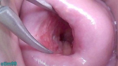 japanese wife Open Cervix wide to see inwards Uterus